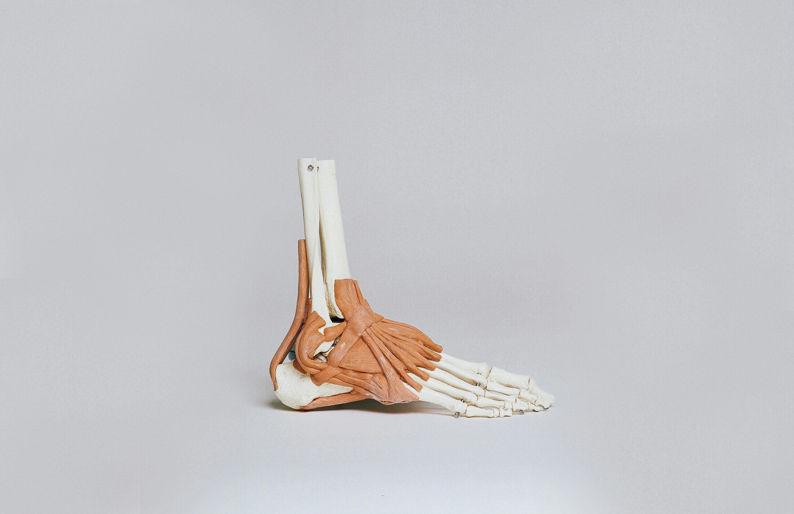 Ankle ligament sprain